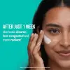Even Smoother™ Mikrodermabrazyon Peeling Gözenek Arıtıcı