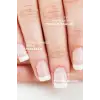 Gold Nail Plus Tırnak Solüsyonu 15 Ml