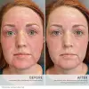 HydroPure Color Correcting Serum