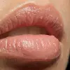 Lip Treat Dudak Balmı 10 ml