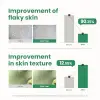 Pha Resurfacing Glow Peel Yüz Peelingi 50 ml