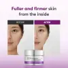 Reedle Shot Lifting Cream