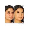 Shape Tape Radiant Concealer, 35N Medium, 10 ml, Kapatıcı