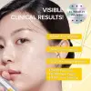 Smart Retinol Spicule PDRN Retinol Krem 15gr