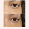 Total Eye Lift Göz Kremi 15 ml