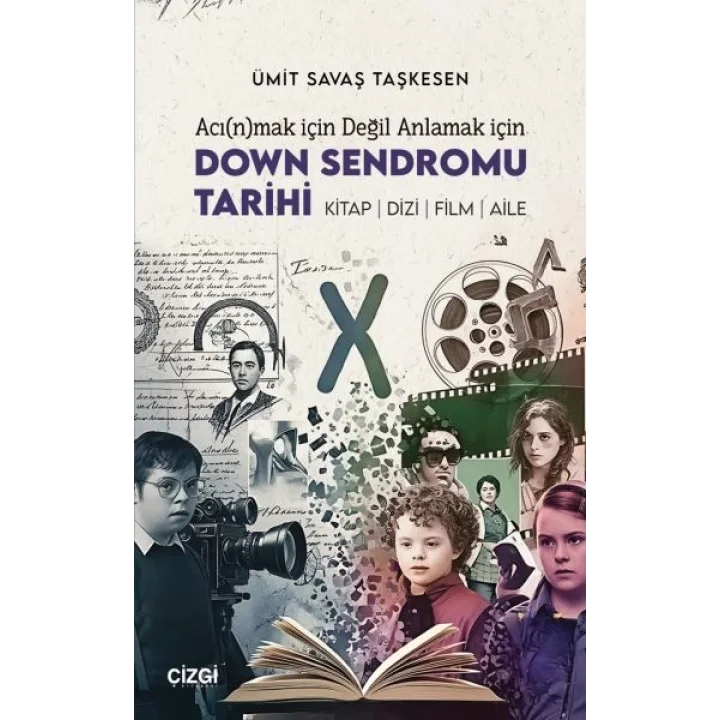 Acı(n)mak İçin Değil Anlamak İçin Down Sendromu Tarihi