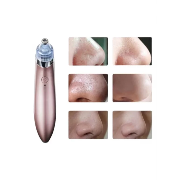 Mey İthalat® SİYAH NOKTA CİHAZI
