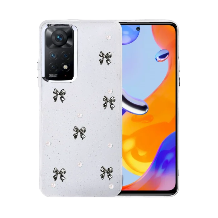 Mey İthalat®   Redmi Note 11 Pro Fiyonk Desenli Kapak - Desen 8