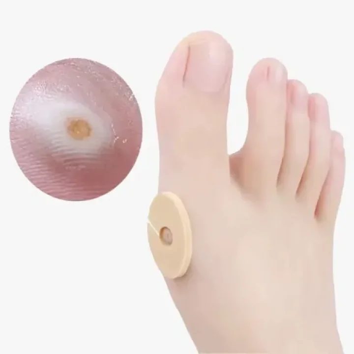 Mey İthalat® Nasır Bandı
