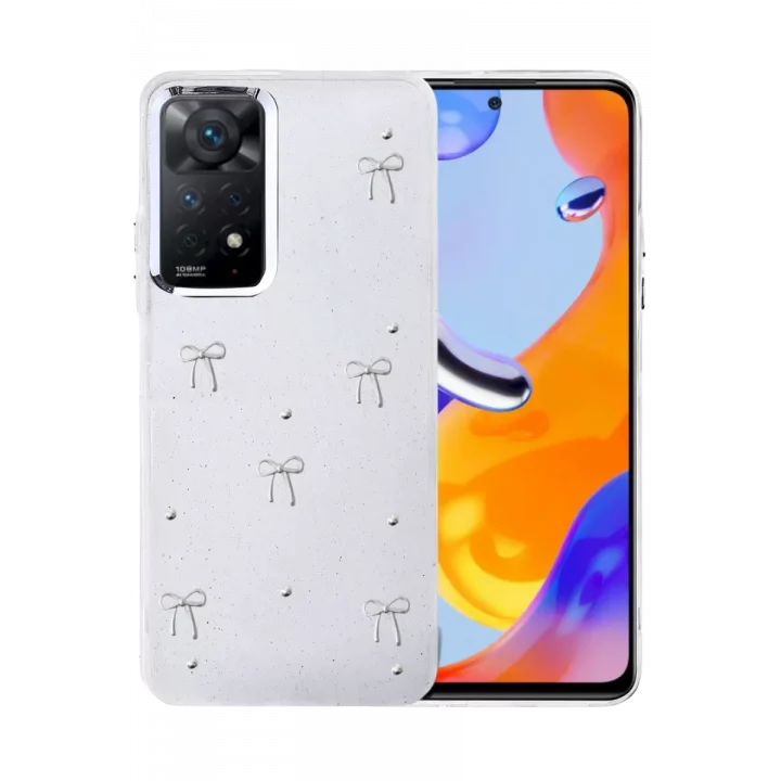 Mey İthalat®   Redmi Note 11 Pro Fiyonk Desenli Kapak - Desen 5