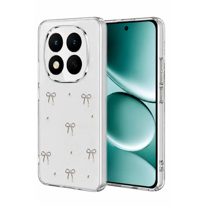 Mey İthalat®   Redmi Note 15 Pro 4G Fiyonk Desenli Kapak - Desen 5