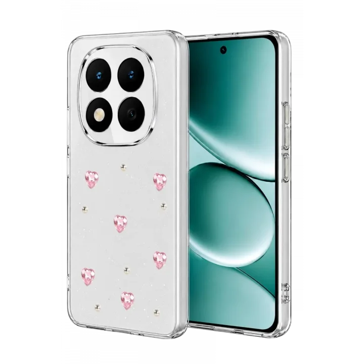 Mey İthalat®   Redmi Note 15 Pro 5G Fiyonk Desenli Kapak - Desen 3