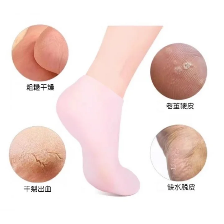 Mey İthalat® Silikon Nemlendirici Çorap Ayak Bakım Çorabı Pembe