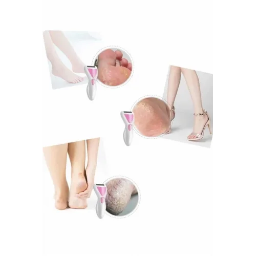 Mey İthalat® Epilatör Cihazı Epilasyon Aleti Çoklu Başlık Seçeneği Ayak Törpüsü