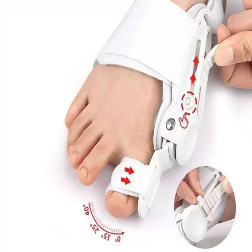 Mey İthalat® Ayarlanabilir Ayak Baş Parmak Kemik Düzeltici – Halluks Valgus (Bunyon) Aparatı, Gece Gündüz Kullanıma Uygun Ayak Düzeltme Ateli