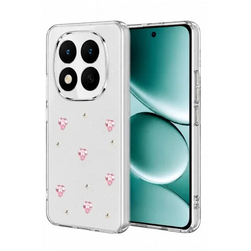 Mey İthalat® Redmi Note 15 Pro Plus 5G Fiyonk Desenli Kapak - Desen 3