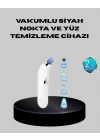 Mey İthalat® 5 Kademeli Vakumlu Gözenek Temizleyici – Su Geçirmez ve Taşınabilir Siyah Nokta Cihazı
