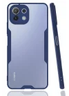 Mey İthalat®  Xiaomi Mİ 11 Lite Kılıf Platin Silikon - Lacivert