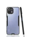 Mey İthalat®  Xiaomi Mİ 11 Lite Kılıf Platin Silikon - Siyah