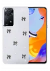 Mey İthalat®   Redmi Note 11 Pro Fiyonk Desenli Kapak - Desen 8