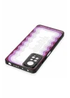 Mey İthalat®   Redmi Note 11 Pro Kılıf Mirror Desenli Kapak - Mirror - 5