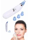 Mey İthalat® Yeni Nesil Vakumlu Pilli Siyah Nokta ve Yüz Temizleme Cihazı 4 Başlıklı