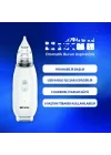 Mey İthalat® Elektrikli Burun Aspiratörü