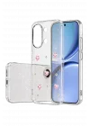 Mey İthalat®   Poco X8 Pro Max Fiyonk Desenli Kapak - Desen 3