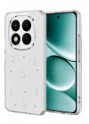 Mey İthalat®   Redmi Note 15 4G Fiyonk Desenli Kapak - Desen 4