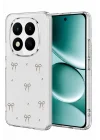 Mey İthalat®   Redmi Note 15 Pro 4G Fiyonk Desenli Kapak - Desen 5