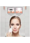 Mey İthalat® ULTRASONIC SİYAH NOKTA  AKNE SPATULA ŞARJLI CİLT TEMİZLEYİCİ