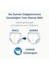 Yetişkin Hasta Bantlı Bez X-Large 120 Adet – Yüksek Emicilik