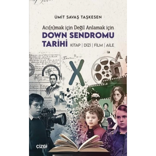 Acı(n)mak İçin Değil Anlamak İçin Down Sendromu Tarihi