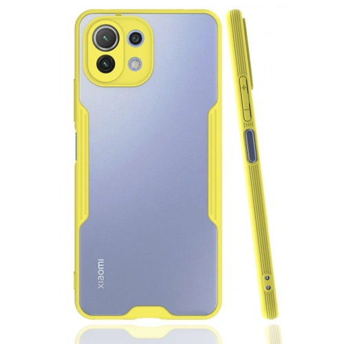 BFS  Xiaomi Mİ 11 Lite Kılıf Platin Silikon - Sarı