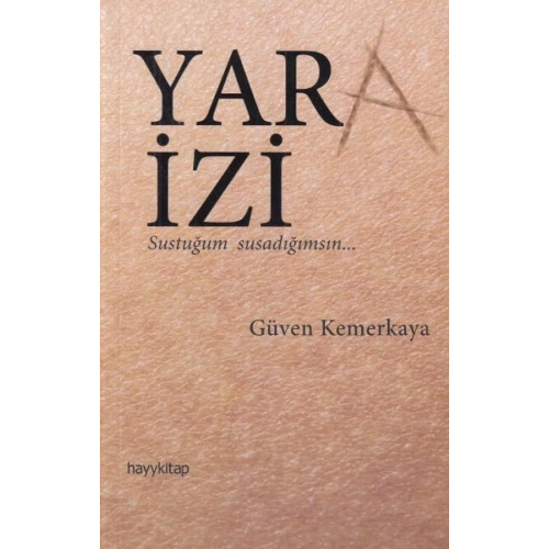 Yara İzi