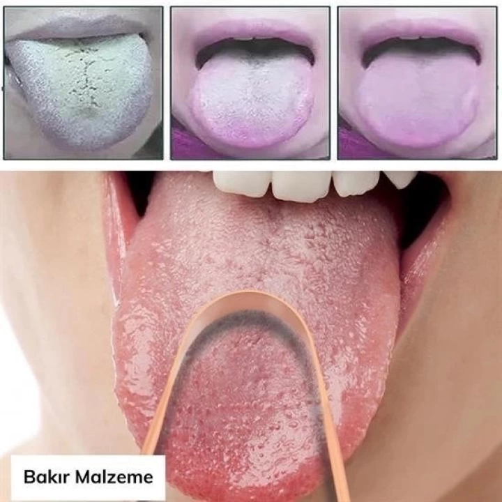 BFS  Bakır Oil Pulling Yağ Çekme Dil Plak Temizleme Aleti Dil Fırçası Sıyırıcı Dil Kaşığı