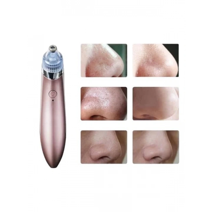 BFS SİYAH NOKTA CİHAZI