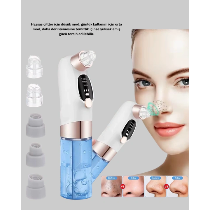 BFS Vakum Teknolojili Siyah Nokta Temizleyici – Cilt Tonu Eşitleyen Masajlı Cilt Bakım Cihazı