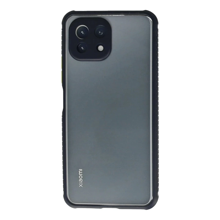 BFS  Xiaomi Mİ 11 Lite Kılıf Miami Şeffaf Silikon - Lacivert