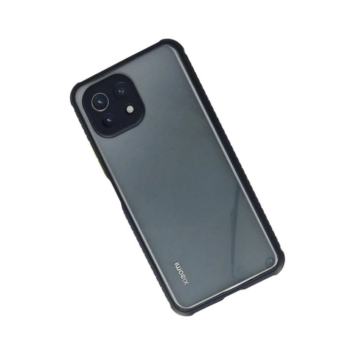 BFS  Xiaomi Mİ 11 Lite Kılıf Miami Şeffaf Silikon - Lacivert
