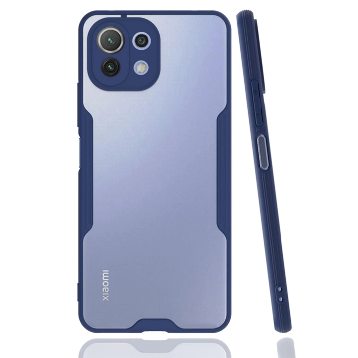 BFS  Xiaomi Mİ 11 Lite Kılıf Platin Silikon - Lacivert