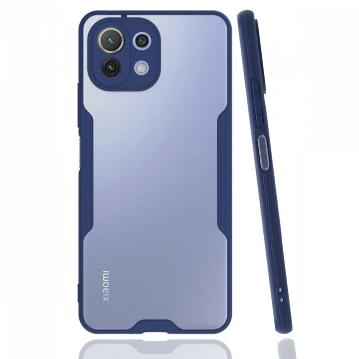 BFS  Xiaomi Mİ 11 Lite Kılıf Platin Silikon - Lacivert