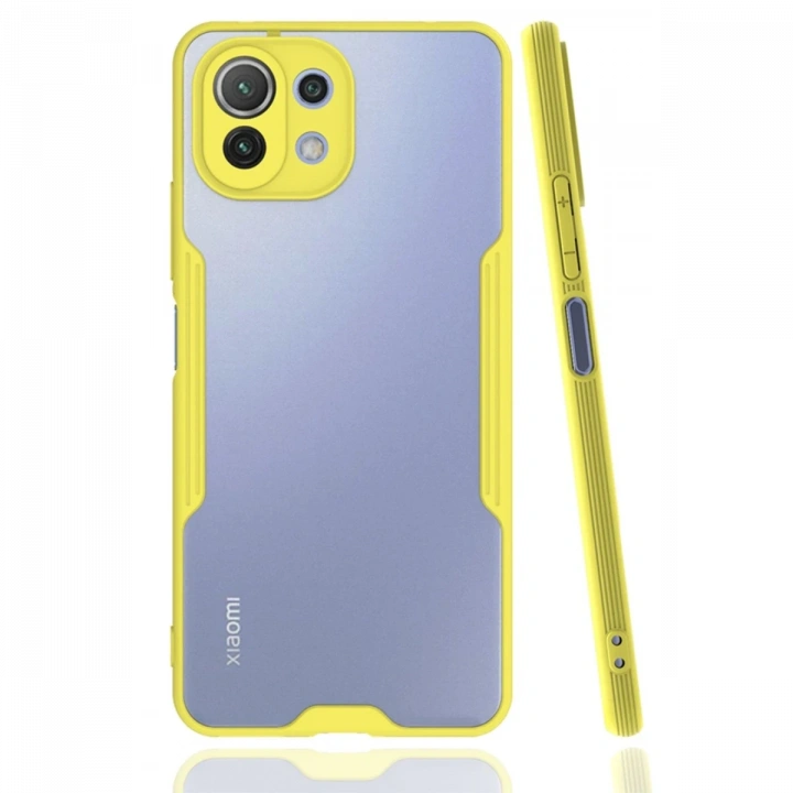 BFS  Xiaomi Mİ 11 Lite Kılıf Platin Silikon - Sarı