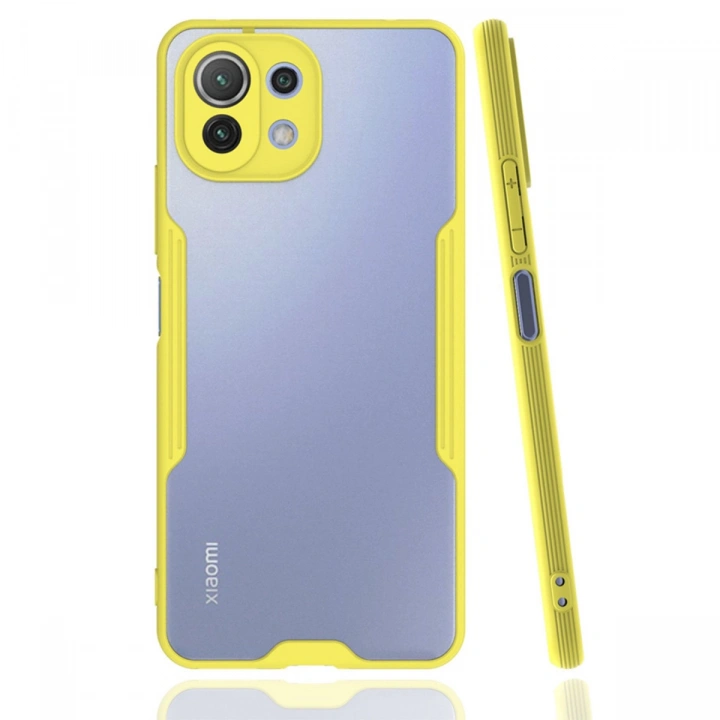 BFS  Xiaomi Mİ 11 Lite Kılıf Platin Silikon - Sarı