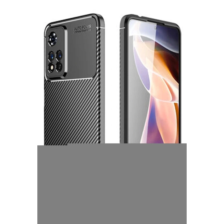 BFS  Xiaomi Redmi Note 11 Pro Plus 5G Kılıf Auto Focus Karbon Kapak - Siyah