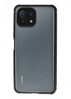 BFS  Xiaomi Mİ 11 Lite Kılıf Miami Şeffaf Silikon - Siyah