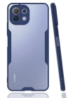 BFS  Xiaomi Mİ 11 Lite Kılıf Platin Silikon - Lacivert