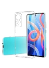 BFS  Xiaomi Mi 12 Kılıf Lüx Şeffaf Silikon
