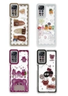 BFS  Xiaomi Redmi Note 11 Kılıf Sweet Desenli Silikon Kapak - Pembe