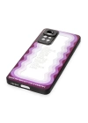 BFS  Xiaomi Redmi Note 11 Pro Kılıf Mirror Desenli Kapak - Mirror - 5